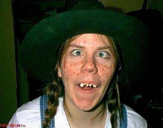 595e600b1bb05_crookedteeth.jpg.132f949546f5d91d03987cbd40cfc5cc.jpg
