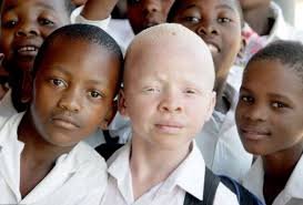 albino.jpg.bc9e2288dec307d46283338c3b9e5240.jpg