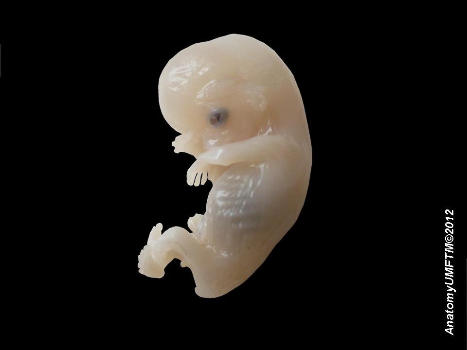 Human_embryo.jpg.7d7b9fe593d037973c37efe36e9f6d47.jpg
